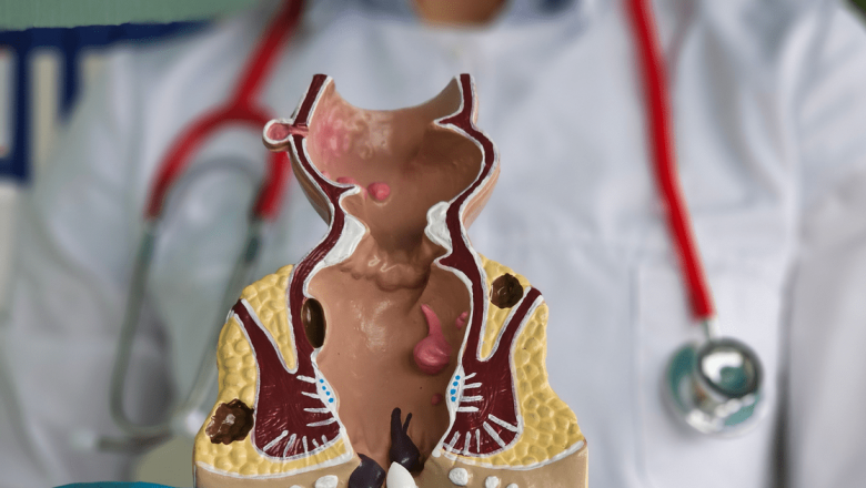 Proctologul: Rolul esențial al chirurgului colorectal în sănătatea intestinală