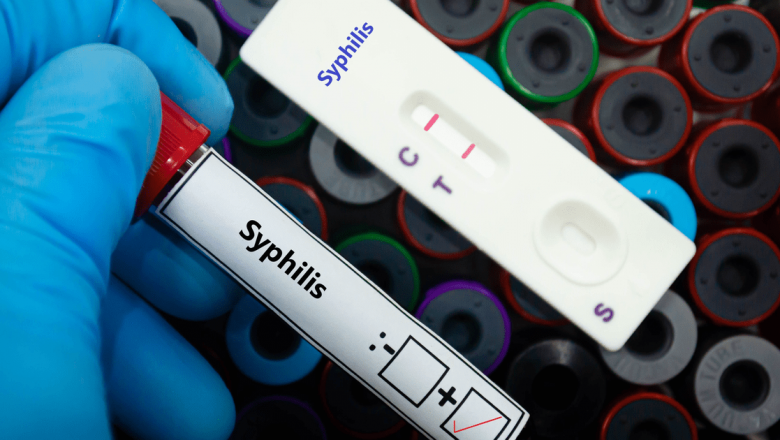Sifilisul: Semne, Simptome și Implicații ale unei Infecții cu Transmitere Sexuală
