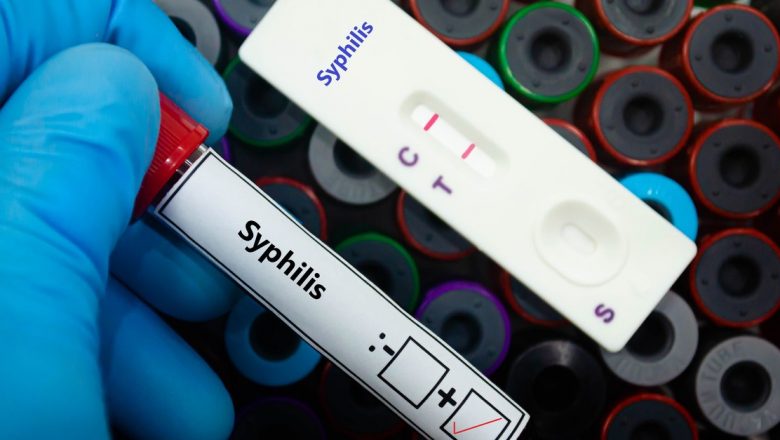 Înțelegerea Sifilisului: Semne, Simptome și Implicații ale unei Infecții cu Transmitere Sexuală