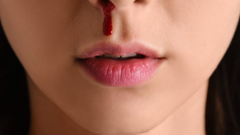Sângerările Nazale: Cauze, Tratament și Prevenție – Tot Ce Trebuie Să Știi
