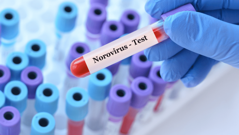 Norovirusul: Patogenul Perfect – Ce Trebuie Să Știm pentru a ne Proteja