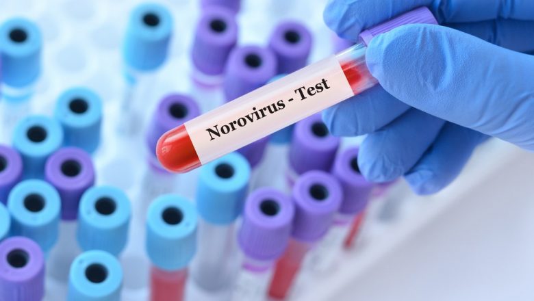 Norovirusul: Un Patogen Perfect și Măsuri de Protecție Împotriva Acestuia