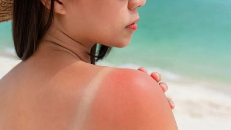 Aloe Vera: Planta Minune pentru Vindecarea Arsurilor și Rănilor