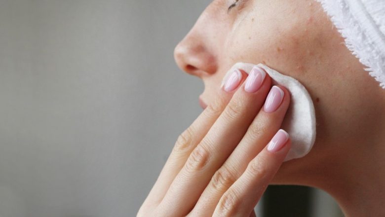 Acneea la Vârsta Adultă: Cauze Ascunse și Soluții Eficiente pentru O Problemă Tot Mai Comună
