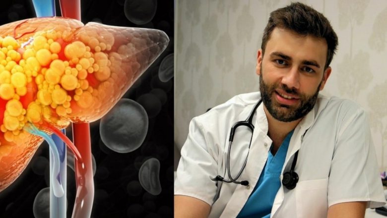 Ficatul Gras: Alimente de Evitat și Soluții pentru Tratament – Ghid Complet de la Dr. Marius Sava