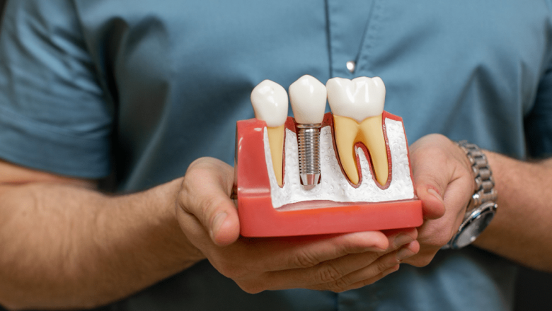 7 Provocări Critice Care Pot Afecta Succesul Implanturilor Dentare și Urgențele Stomatologice Asociate