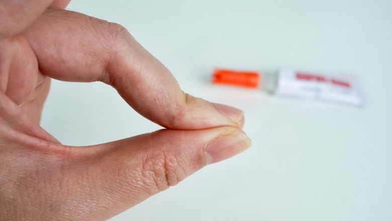 Ghid Complet pentru Îndepărtarea Superglue-ului de pe Piele: Soluții Eficiente și Precauții