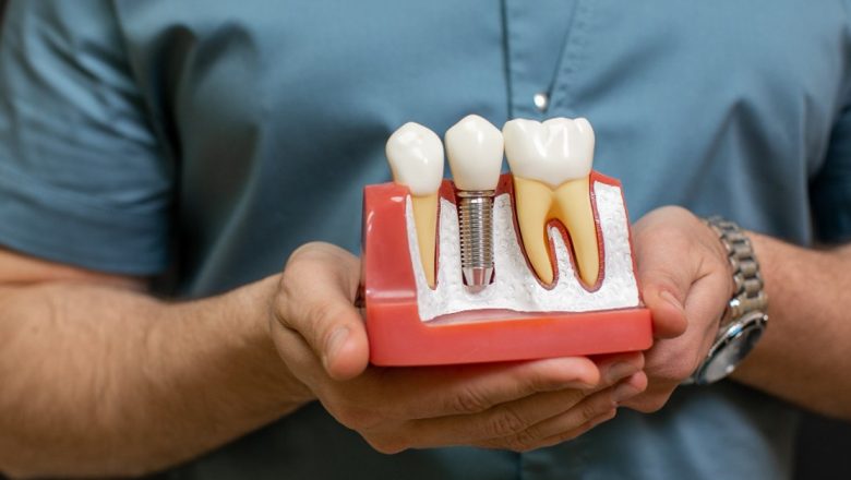 Factorii Critici care Pot Afecta Succesul Implanturilor Dentare și Urgențele Stomatologice Asociate