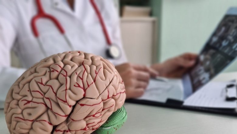 Prevenirea Accidentului Vascular Cerebral: Obiceiuri Esențiale și Dieta Mediteraneană
