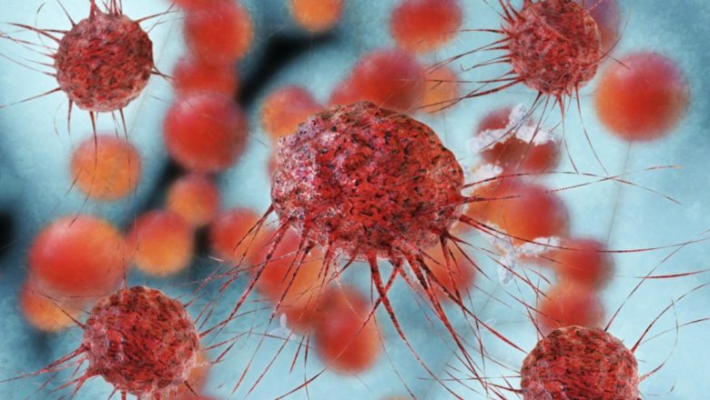 Cancerul Sângelui: O Privire Detaliată asupra Leucemiei, Limfomului și Mielomului Multiplu