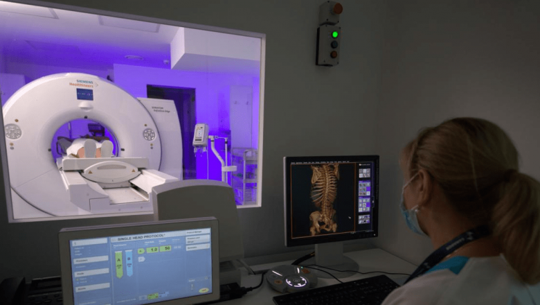 Prevenirea cancerului bronhopulmonar: Măsuri esențiale pentru o viață sănătoasă