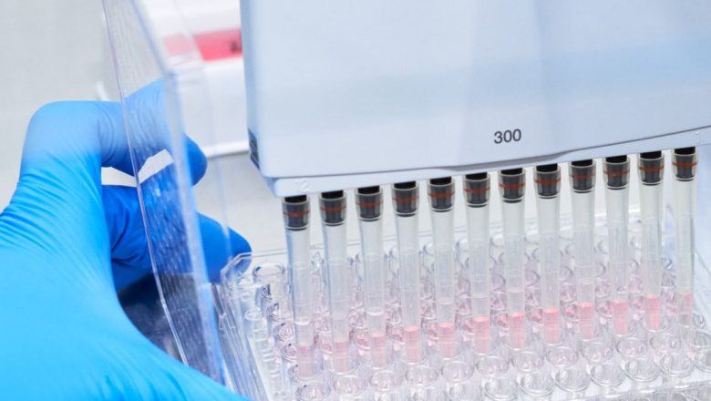 Revoluția diagnosticării Alzheimer: Testul de sânge minim invaziv Elecsys® pTau181 disponibil în România