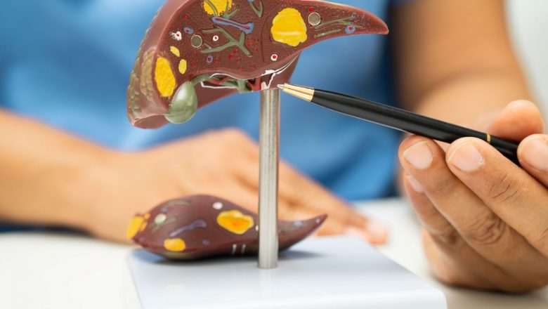 Boala ficatului gras: Un risc major pentru cancerul hepatic și sănătatea generală