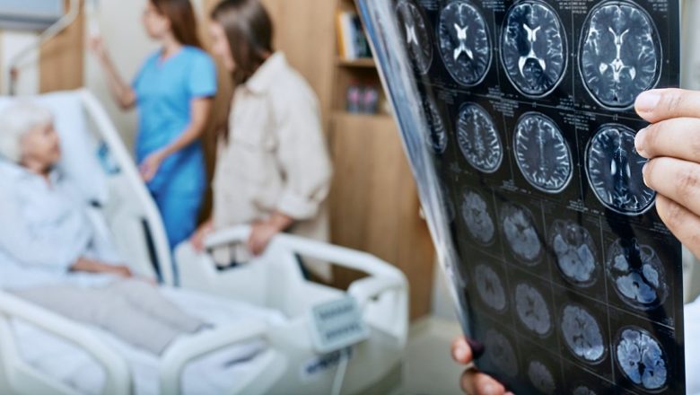 Legătura Între Virusul Herpesului și Creșterea Riscului de Alzheimer: O Descoperire Îngrijorătoare