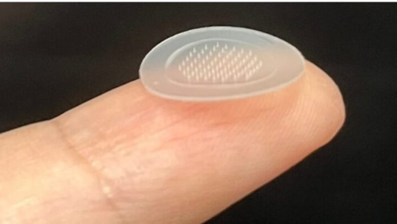 Revoluția plasturelui inteligent cu microace: Cum o inovație medicală promite să transforme tratamentul acneei în rândul adolescenților