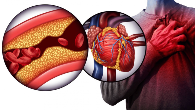 Impactul consumului excesiv de zahăr asupra colesterolului și sănătății cardiovasculare