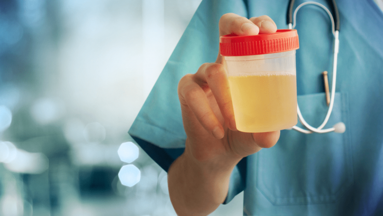 Legătura surprinzătoare dintre urină și riscul de demență: O nouă direcție în prevenție