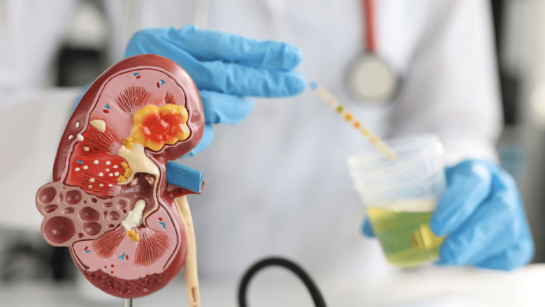 Alimentația și Pietrele la Rinichi: Ce Trebuie Să Știm pentru a Preveni Această Afecțiune Dureroasă
