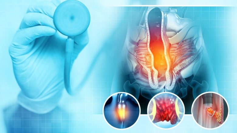 Cancerul anal: Importanța recunoașterii simptomelor și prevenirea acestuia