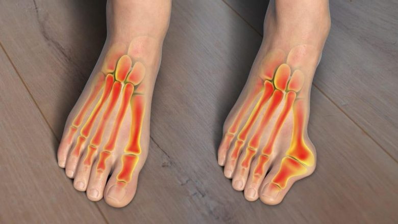 Monturile: O Provocare Medicală Mai Mult Decât Estetică