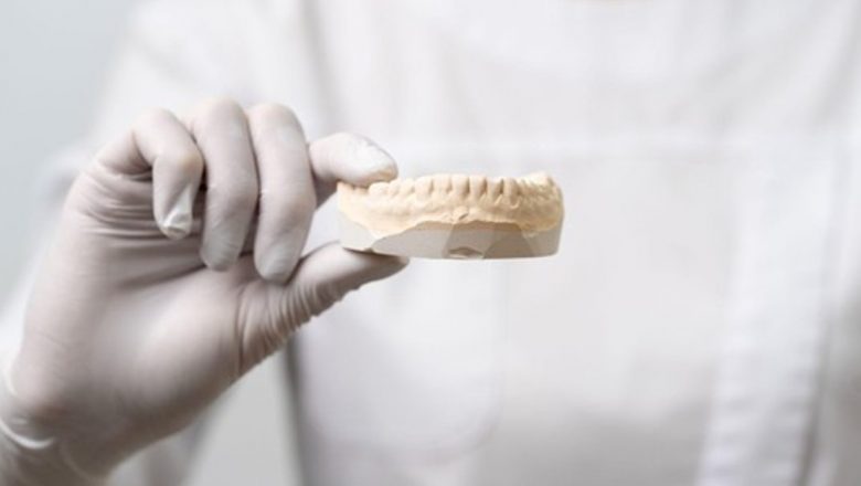 Ghid Complet despre Protezele Dentare: Tipuri, Avantaje și Implicații pentru Sănătate