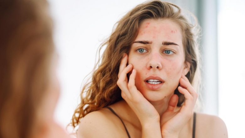 Greșeli Frecvente în Îngrijirea Pielii: Cum Să Evităm Agravarea Problemelor Dermatologice