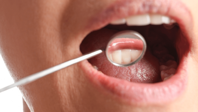 Atenție: Cancerul Oral Poate Debuta cu Răni Banale – Ce Trebuie Să Știm pentru a Ne Proteja