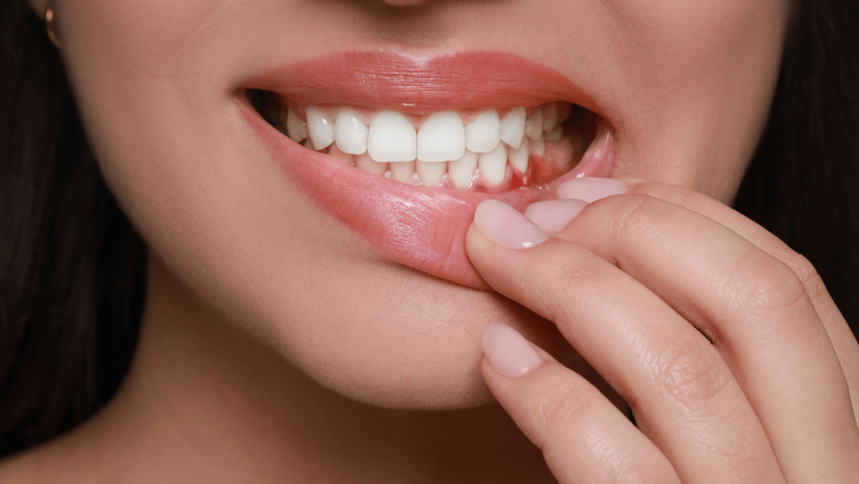Sângerări Gingivale: Cauze, Prevenire și Impactul Asupra Sănătății Generale