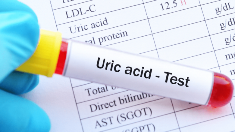 Cum să gestionezi nivelul de acid uric și să previi durerile articulare: Ghid cu remedii naturale și sfaturi practice