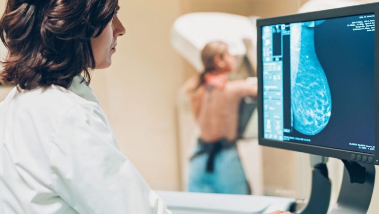 Decizii fundamentale în depistarea cancerului de sân: Vârsta optimă pentru mamografie și implicațiile acesteia