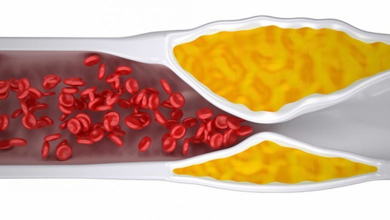 Fructele care pot transforma sănătatea cardiovasculară: cum să reducem trigliceridele și colesterolul prin alimentație