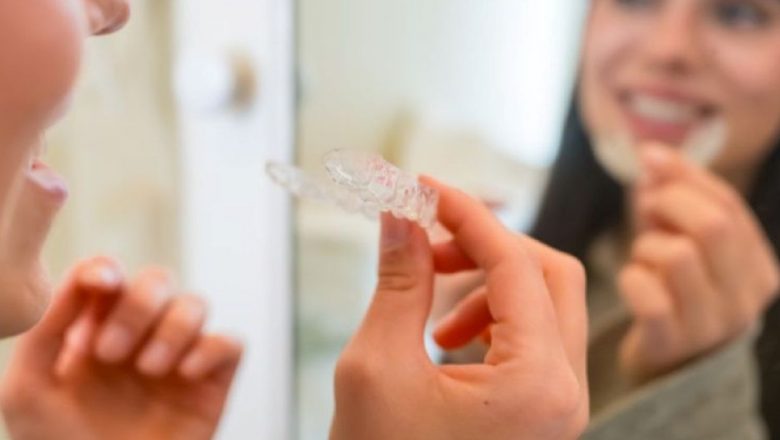 Evaluarea ortodontică la copii: semnele care indică necesitatea unui aparat dentar