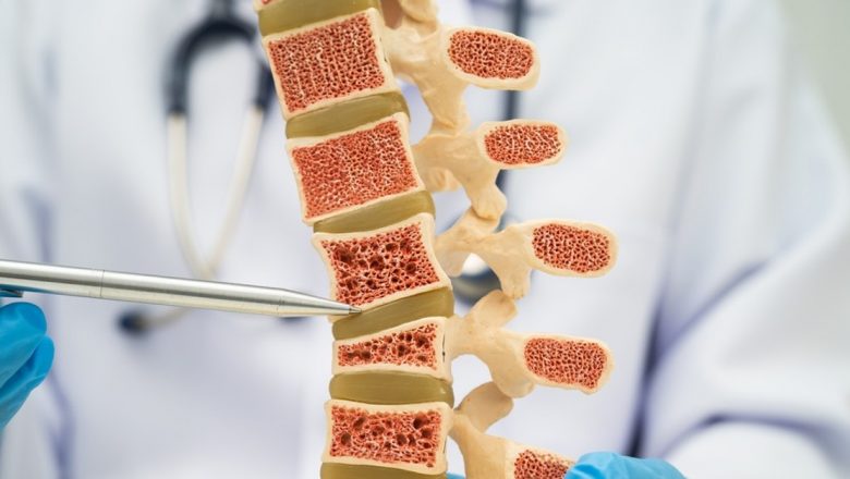 Osteopenia: O afecțiune silențioasă care afectează 40% dintre adulți – Ce trebuie să știm