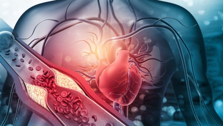 7 Alimente Surprinzătoare care Pot Curăța Arterele: O Analiză Detaliată a Beneficiilor Cardiovasculare