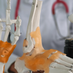 Semnele deficitului de calciu: Ce trebuie să știm despre acest mineral esențial