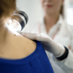 Revoluția în Tratamentul Melanomului: Deschiderea Centrului Terțiar de Melanom Euroclinic