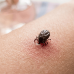 Ghid Complet: Cum Să Te Protejezi de Căpușe și Să Previi Boala Lyme