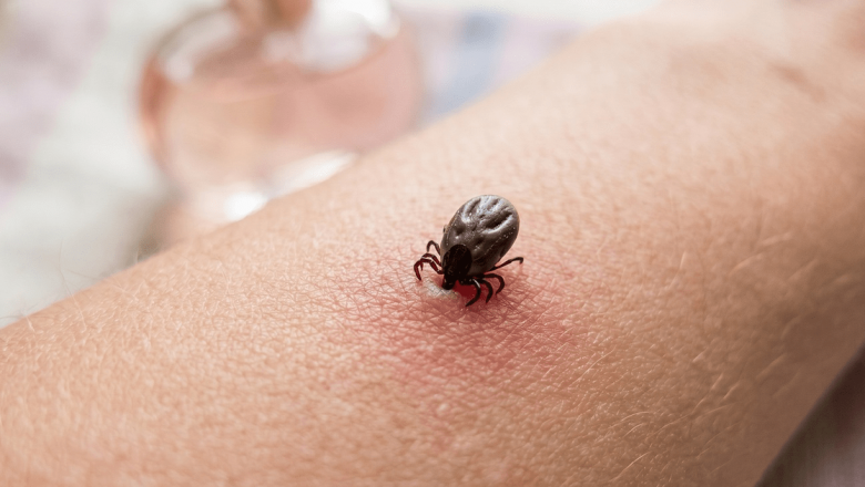 Ghid Complet: Cum Să Te Protejezi de Căpușe și Să Previi Boala Lyme