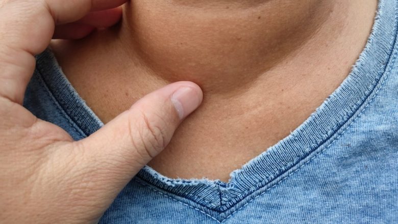 Gușa Tiroidiană: Cauze, Simptome și Opțiuni de Tratament Explicate de Specialiști