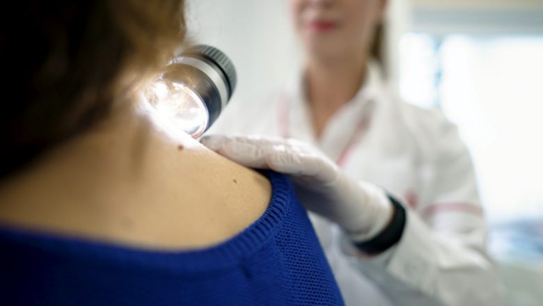 Deschiderea Centrului Terțiar de Melanom Euroclinic: O Nouă Era în Tratamentul Melanomului