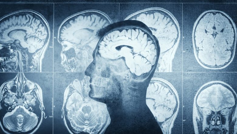 Impactul Poziției de Somn Asupra Sănătății Creierului: O Analiză Detaliată
