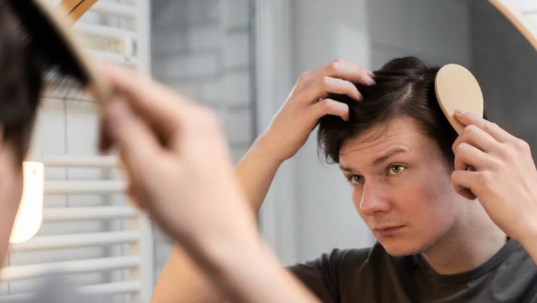 Mătreața: Cauze, Remedii și Strategii de Prevenire pentru un Scalp Sănătos