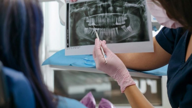 Implant dentar: întrebări esențiale pentru o decizie informată înainte de intervenție