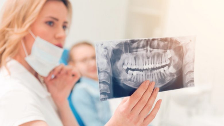 Beneficiile păstrării măselelor de minte: O analiză detaliată asupra sănătății dentare