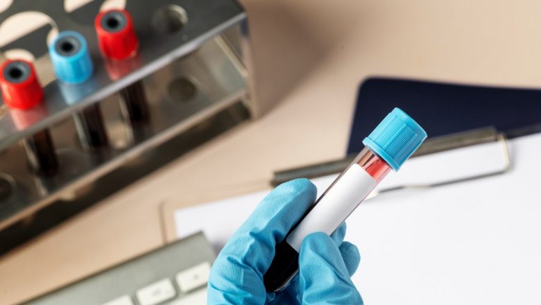 Importanța analizelor de sânge în prevenția sănătății: Profilul lipidic și hormonal